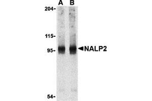 Western Blotting (WB) image for anti-NLR Family, Pyrin Domain Containing 2 (NLRP2) (C-Term) antibody (ABIN1030532) (NLRP2 抗体  (C-Term))