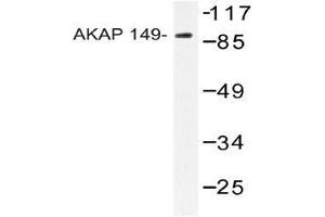 Western blot analysis of AKAP149 Antibody in extracts from HUVEC cells. (AKAP1 抗体)