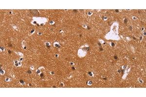 Immunohistochemistry of paraffin-embedded Human brain using CBX3 Polyclonal Antibody at dilution of 1:40 (CBX3 抗体)