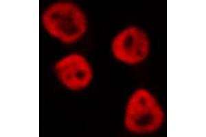 ABIN6268848 staining HeLa cells by IF/ICC. (PPARA 抗体  (N-Term))