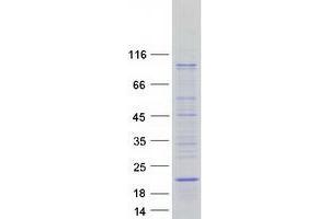 Western Blotting (WB) image for SYS1 Golgi-Localized Integral Membrane Protein Homolog (SYS1) (Transcript Variant 1) protein (Myc-DYKDDDDK Tag) (ABIN2733137)