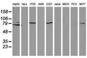 Image no. 2 for anti-Catenin (Cadherin-Associated Protein), beta 1, 88kDa (CTNNB1) antibody (ABIN1496897) (CTNNB1 抗体)