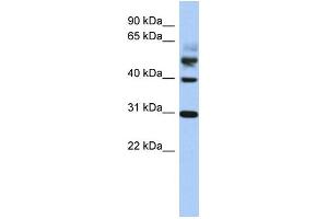 WB Suggested Anti-TTL Antibody Titration: 0. (TTL 抗体  (Middle Region))