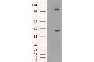 Image no. 7 for anti-Lysyl Oxidase (LOX) (AA 22-168) antibody (ABIN1491218) (LOX 抗体  (AA 22-168))