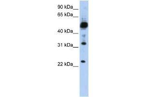 Western Blotting (WB) image for anti-Transmembrane Protein 38B (TMEM38B) antibody (ABIN2459106) (TMEM38B 抗体)