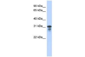 WB Suggested Anti-MED6 Antibody Titration:  0. (MED6 抗体  (Middle Region))