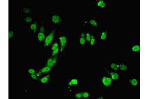 Immunofluorescent analysis of Hela cells using ABIN7150209 at dilution of 1:100 and Alexa Fluor 488-congugated AffiniPure Goat Anti-Rabbit IgG(H+L) (MSH6 抗体  (AA 1-400))