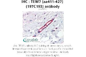 Image no. 1 for anti-Plexin Domain Containing 1 (PLXDC1) (AA 411-427) antibody (ABIN5693726) (PLXDC1 抗体  (AA 411-427))