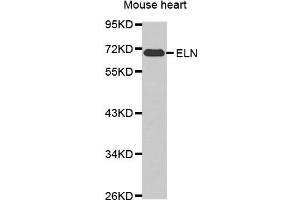 Western blot analysis of extracts of various cell lines, using ELN antibody. (Elastin 抗体  (AA 27-200))
