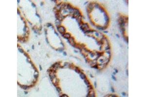Used in DAB staining on fromalin fixed paraffin-embedded Kidney tissue (TLR3 抗体  (AA 727-905))