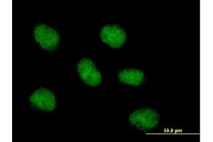 Immunofluorescence of purified MaxPab antibody to MCM10 on HeLa cell. (MCM10 抗体  (AA 1-874))