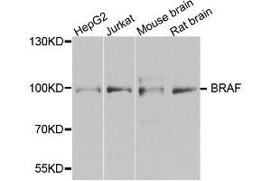 Western blot analysis of extracts of various cell lines, using BRAF antibody. (BRAF 抗体  (AA 280-460))