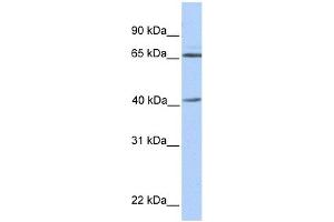 GLA antibody used at 1 ug/ml to detect target protein. (GLA 抗体  (N-Term))