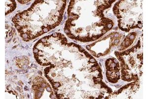 ABIN6268779 at 1/100 staining human kidney tissue sections by IHC-P. (Aquaporin 1 抗体  (Internal Region))
