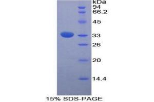 SDS-PAGE analysis of Rat FUCa1 Protein. (FUCA1 蛋白)