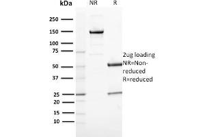 SDS-PAGE Analysis Purified CD163 Mouse Monoclonal Antibody (M130/2164). (CD163 抗体  (AA 43-196))