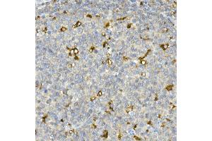 Immunohistochemistry (IHC) image for anti-Cyclin-Dependent Kinase 1 (CDK1) antibody (ABIN7266576)