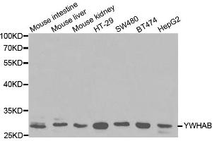 Western blot analysis of extracts of various cell lines, using YWHAB antibody (ABIN5970400) at 1/1000 dilution. (YWHAB 抗体)