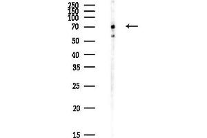 anti-Suppressor of Cancer Cell Invasion (SCAI) antibody
