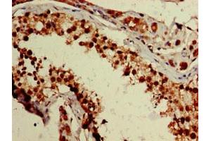 Immunohistochemistry of paraffin-embedded human testis tissue using ABIN7176240 at dilution of 1:100 (ZNF331 抗体  (AA 179-442))