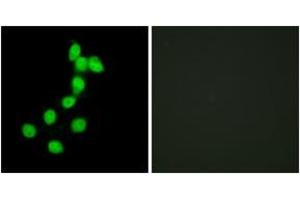 Immunofluorescence analysis of HepG2 cells, using DYR1A Antibody. (DYRK1A 抗体  (AA 21-70))