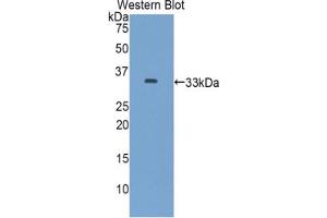 Western blot analysis of the recombinant protein.