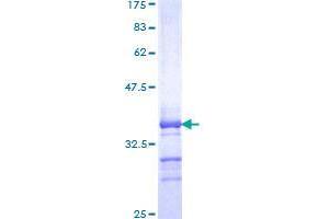 Image no. 1 for Basic Leucine Zipper Transcriptional Factor ATF-Like 3 (BATF3) (AA 48-125) protein (GST tag) (ABIN1346444) (BATF3 Protein (AA 48-125) (GST tag))