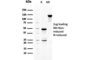 SDS-PAGE Analysis Purified Heregulin-1 Mouse Monoclonal Antibody (NRG1/2710). (Neuregulin 1 抗体  (AA 21-242))