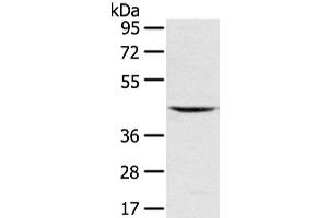 Western Blot analysis of Mouse kidney tissue using VSIG8 Polyclonal Antibody at dilution of 1/400 (VSIG8 抗体)