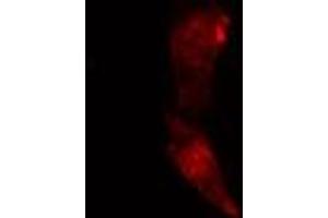 ABIN6274121 staining Hela cells by IF/ICC. (TACC1 抗体  (N-Term))