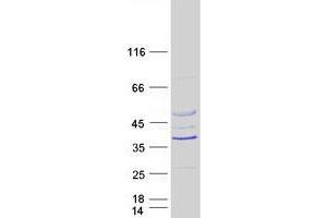 Validation with Western Blot