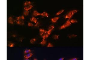 Immunofluorescence analysis of C6 cells using DPP4 Polyclonal Antibody at dilution of 1:100. (DPP4 抗体)