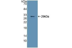 Detection of Recombinant MAPK11, Human using Polyclonal Antibody to Mitogen Activated Protein Kinase 11 (MAPK11)