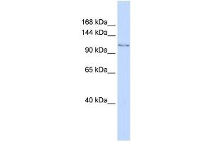WB Suggested Anti-JHDM1D Antibody Titration: 0. (JHDM1D 抗体  (C-Term))