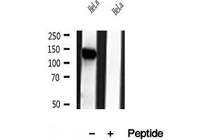 Western blot analysis of extracts of HeLa cells, using NBR1 antibody. (NBR1 抗体)