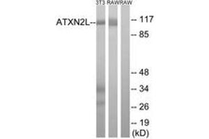 Western blot analysis of extracts from NIH-3T3/RAW264. (Ataxin 2-Like 抗体  (AA 571-620))