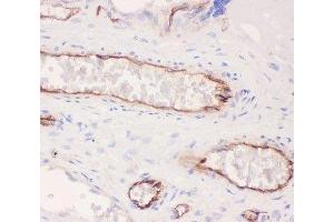 IHC-P: ACE antibody testing of human placenta tissue (Angiotensin I Converting Enzyme 1 抗体  (AA 651-864))