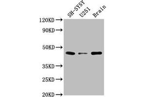 Western Blot Positive WB detected in: SH-SY5Y whole cell lysate, U251 whole cell lysate, Rat brain tissue All lanes: LRTM2 antibody at 1:2000 Secondary Goat polyclonal to rabbit IgG at 1/50000 dilution Predicted band size: 42 kDa Observed band size: 42 kDa (LRTM2 抗体  (AA 36-310))