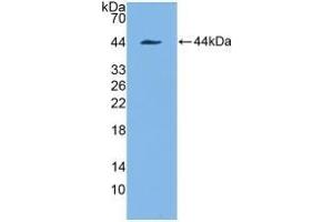 Detection of Recombinant KRT7, Human using Polyclonal Antibody to Cytokeratin 7 (CK7) (Cytokeratin 7 抗体  (AA 91-394))