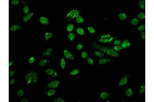 Immunofluorescence (IF) image for anti-Histone Cluster 1, H3a (HIST1H3A) (pThr80) antibody (ABIN7139630)