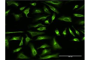 Immunofluorescence of monoclonal antibody to PRC1 on HeLa cell. (PRC1 抗体  (AA 1-620))