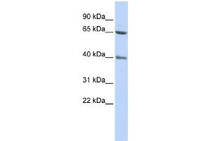WB Suggested Anti-ZNF192 Antibody Titration:  0. (ZNF192 抗体  (N-Term))