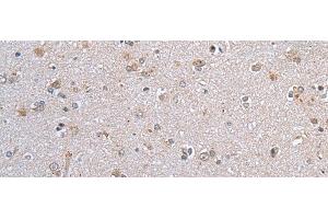 Immunohistochemistry of paraffin-embedded Human brain tissue using CLDN12 Polyclonal Antibody at dilution of 1:45(x200) (Claudin 12 抗体)