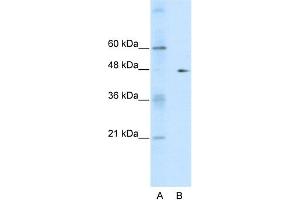 WB Suggested Anti-GDI2  Antibody Titration: 0. (GDI2 抗体  (C-Term))