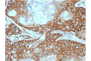 Immunohistochemistry (IHC) image for anti-Ribosomal Protein SA (RPSA) antibody (ABIN6939957)