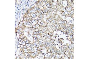Immunohistochemistry (IHC) image for anti-Solute Carrier Family 16 (Monocarboxylic Acid Transporters), Member 3 (SLC16A3) (AA 371-465) antibody (ABIN6147859)
