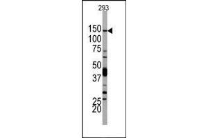 Image no. 1 for anti-Phosphoinositide-3-Kinase, Catalytic, delta Polypeptide (PIK3CD) (N-Term) antibody (ABIN360449) (PIK3CD 抗体  (N-Term))