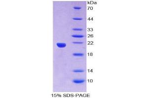 SDS-PAGE (SDS) image for Small Nuclear Ribonucleoprotein Polypeptide C (SNRPC) (AA 2-159) protein (His tag) (ABIN2126798) (SNRPC Protein (AA 2-159) (His tag))