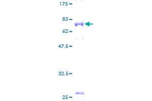 Image no. 1 for GDNF Family Receptor alpha 3 (GFRA3) (AA 1-400) protein (GST tag) (ABIN1355036)