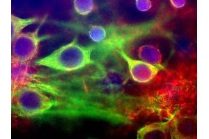 High Magnification view of mixed neuron/glial cultures stained with our MARCKS antibody (red) and CPCA-MAP2, antibody to MAP2 made in chicken. (MARCKS 抗体)